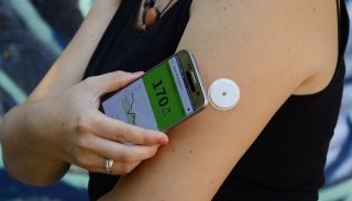 Пациентам установлены датчики непрерывного мониторинга глюкозы